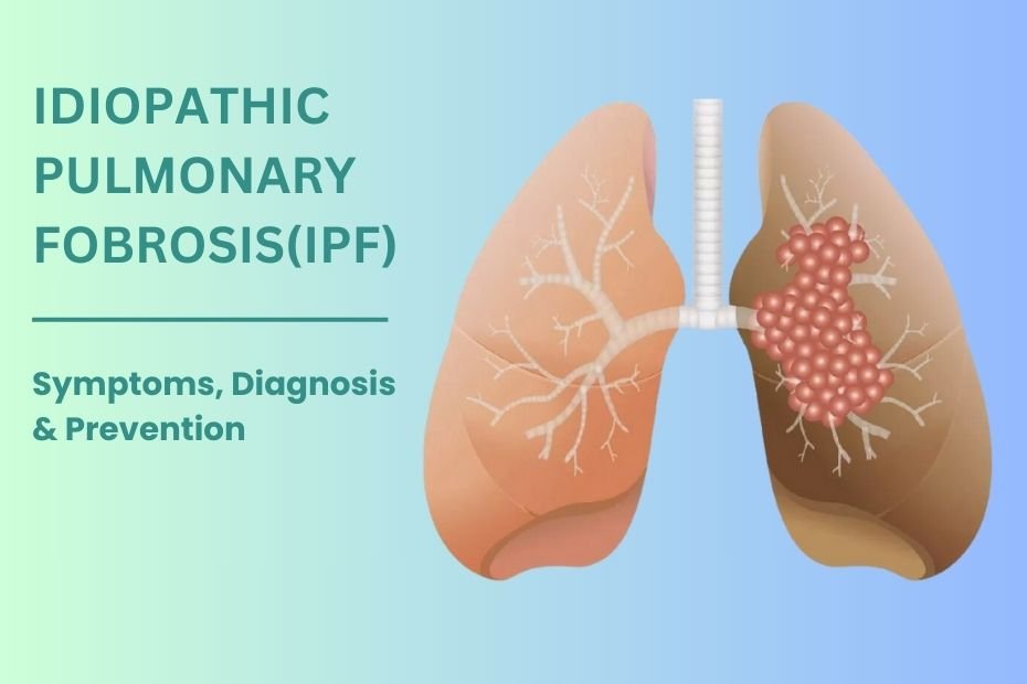 Idiopathic Pulmonary Fibrosis (IPF) | Symptoms & Treatment