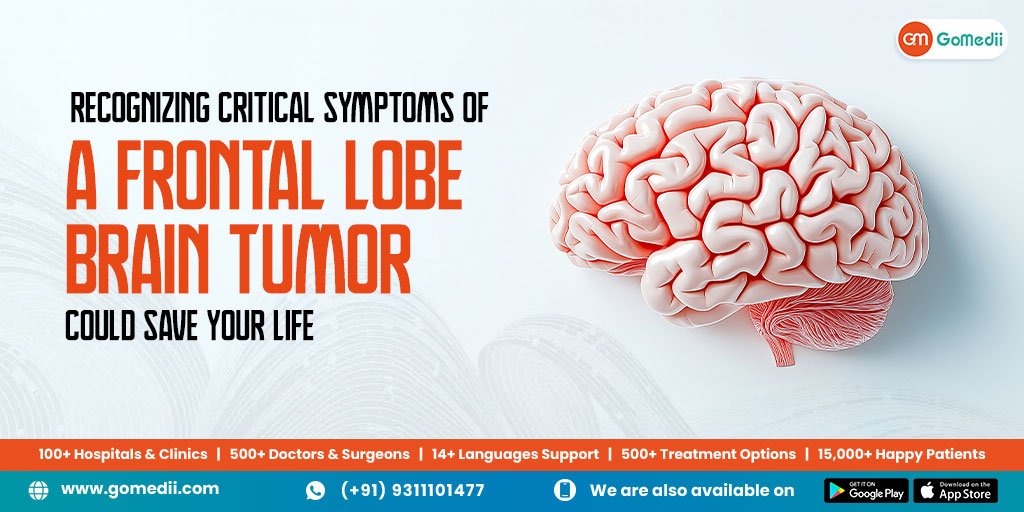 Recognizing Critical Symptoms of a Frontal Lobe Brain Tumor Could Save Your Life